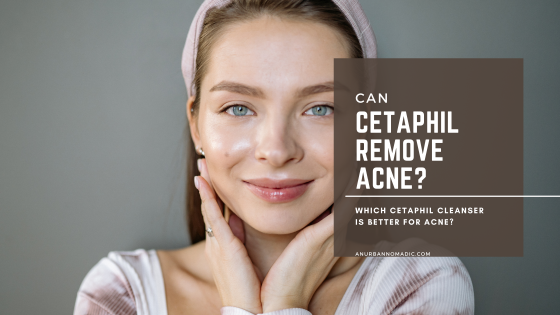 Can Cetaphil remove acne